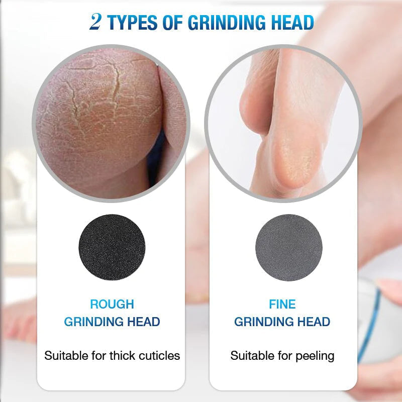 Electric Vacuum Foot Grinder