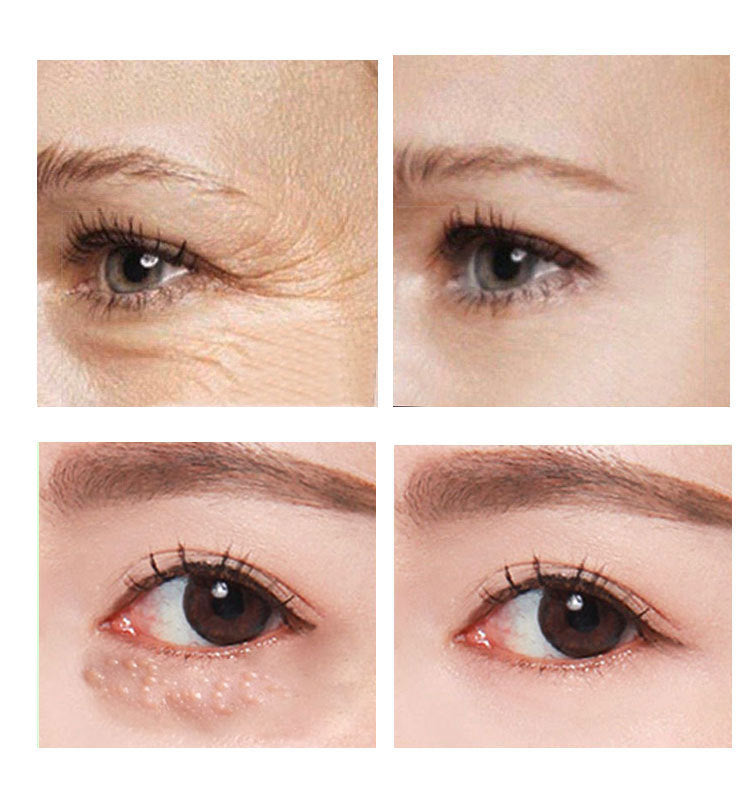 Beauty Eye Cream – 30ml